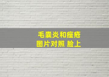 毛囊炎和痤疮图片对照 脸上